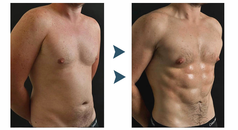 Fitness Corset Men's Shapewear Heat Trapping Shirt Sweat Body Shaper Vest Bodysuit 21 Fitness Corset Men's Shapewear Heat Trapping Shirt Sweat Body Shaper Vest Bodysuit